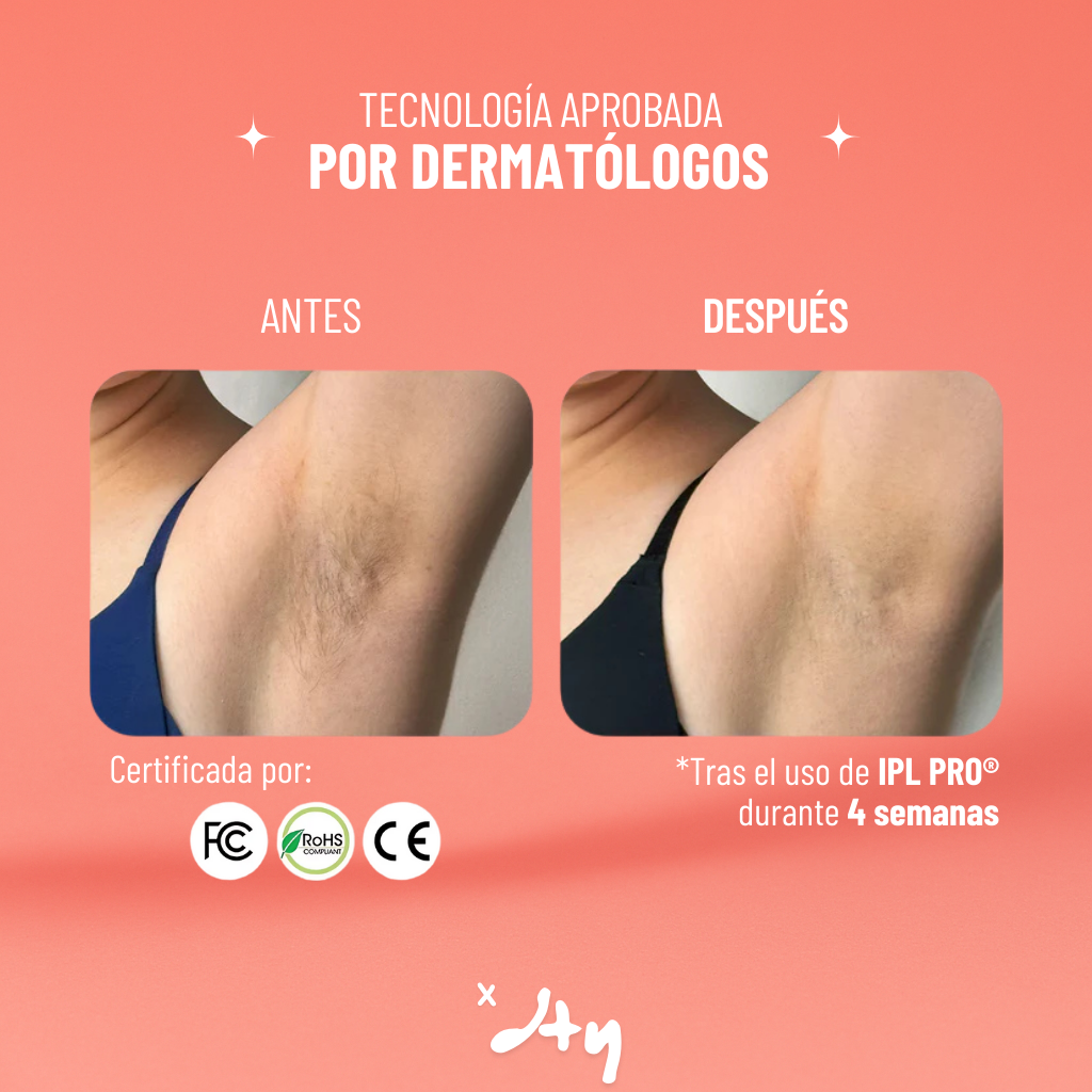 IPL PRO® | Depilación permanente